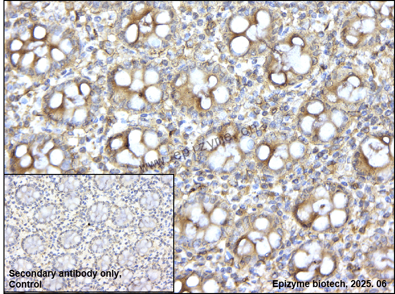 Anti-ADRA1A Rabbit mAb [53L84L63]