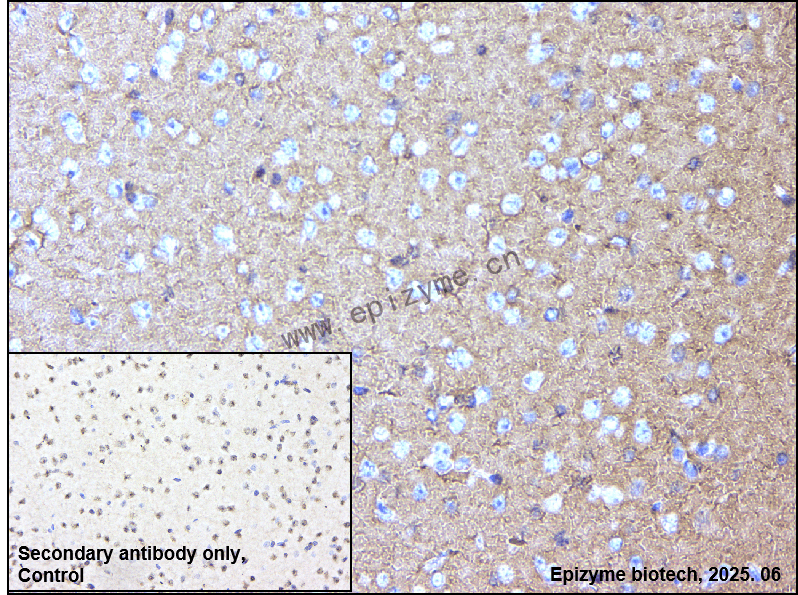 Anti-ADRA1A Rabbit mAb [53L84L63]