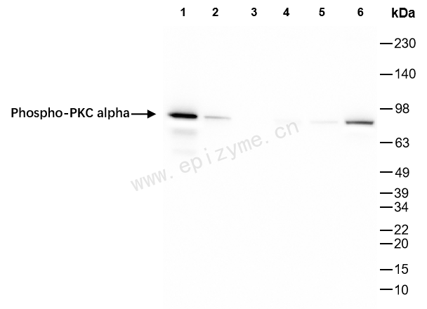 Anti-Phospho-PKC alpha (Ser657) Rabbit mAb [34M80M77]