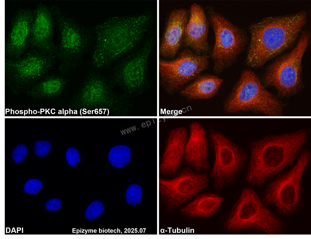 Anti-Phospho-PKC alpha (Ser657) Rabbit mAb [34M80M77]