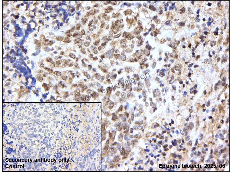 Anti-Phospho-PKC alpha (Ser657) Rabbit mAb [34M80M77]