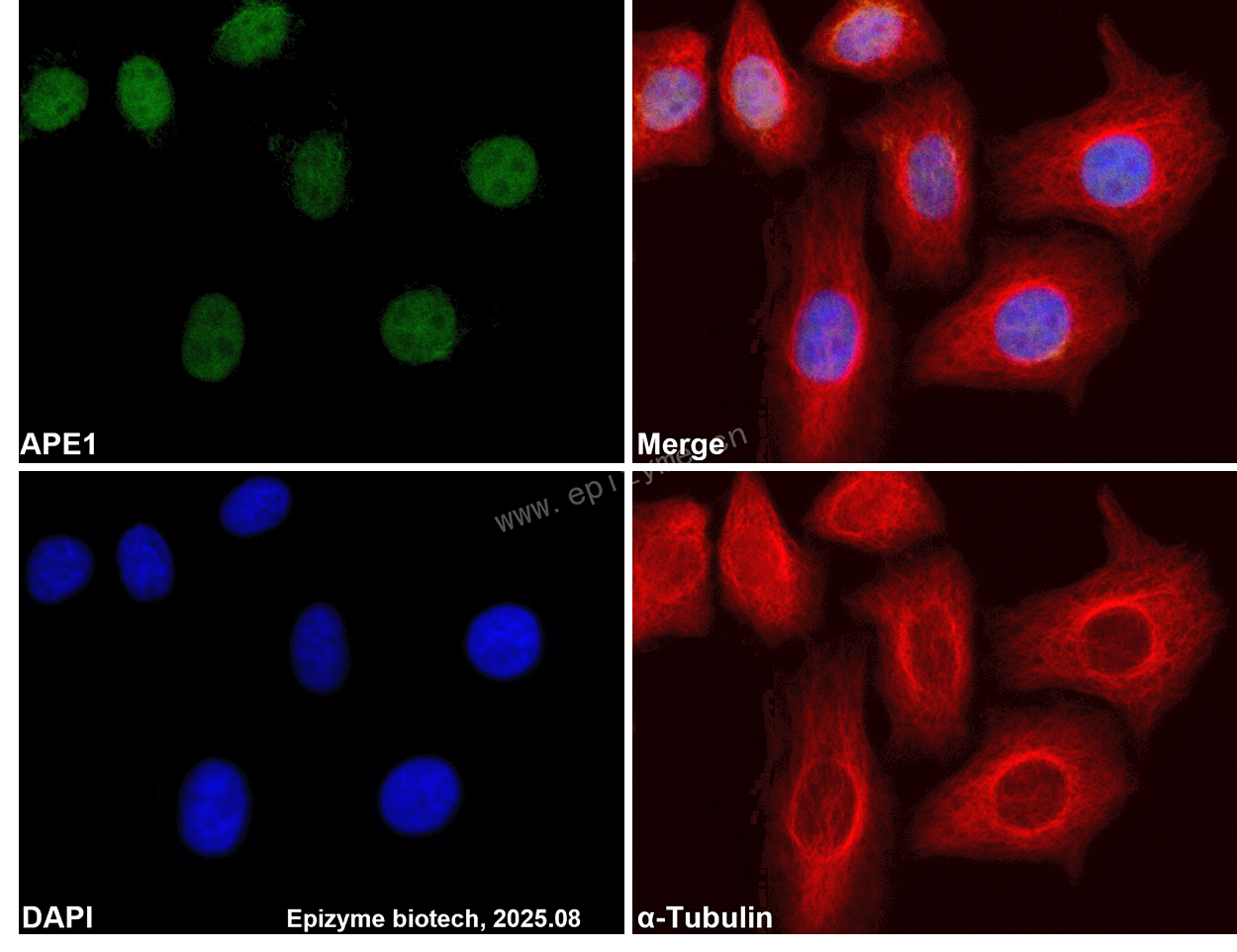 Anti-APEX1 Rabbit mAb [55L25L18]