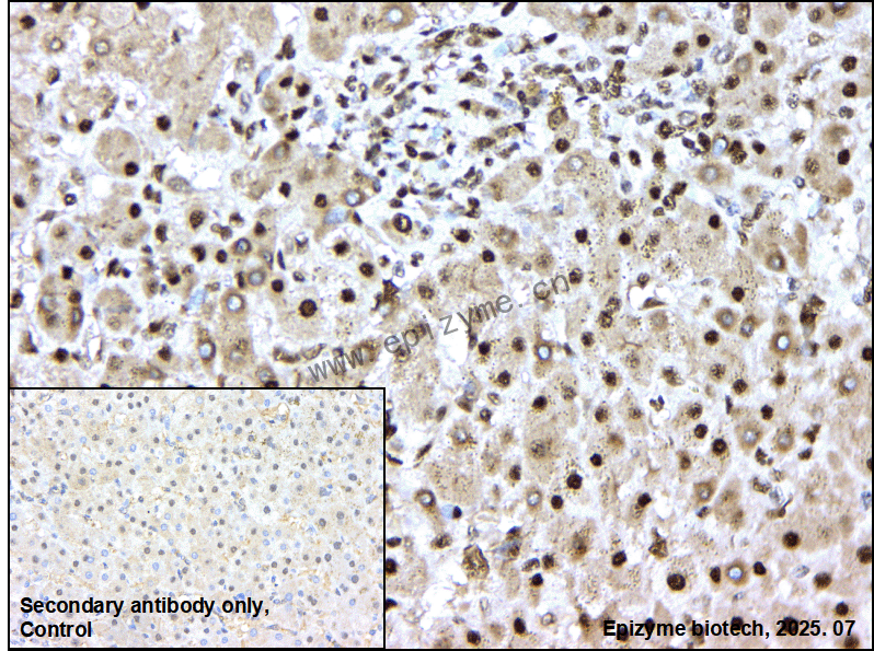 Anti-APEX1 Rabbit mAb [55L25L18]