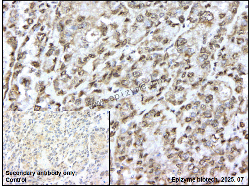 Anti-APEX1 Rabbit mAb [55L25L18]