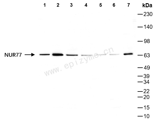 Anti-NUR77 Rabbit mAb [19L28K63]