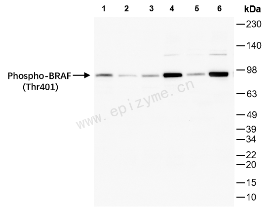 Anti-Phospho-BRAF (Thr401) Rabbit mAb [86K47L17]