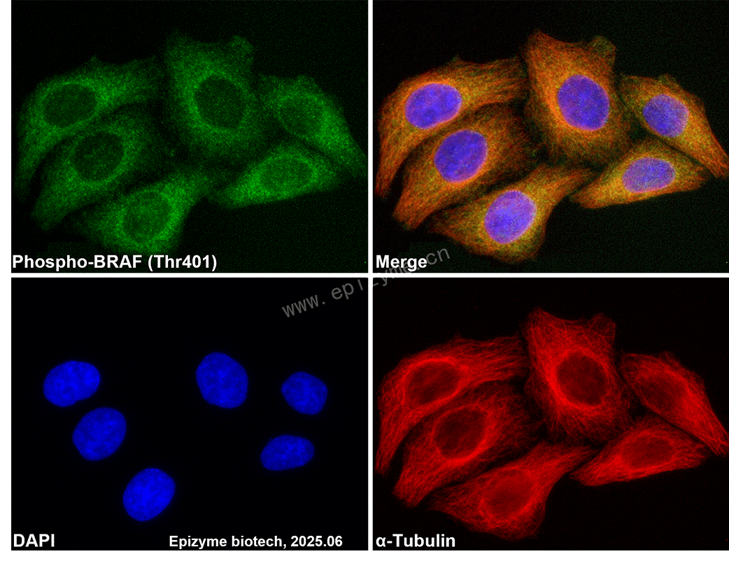Anti-Phospho-BRAF (Thr401) Rabbit mAb [86K47L17]