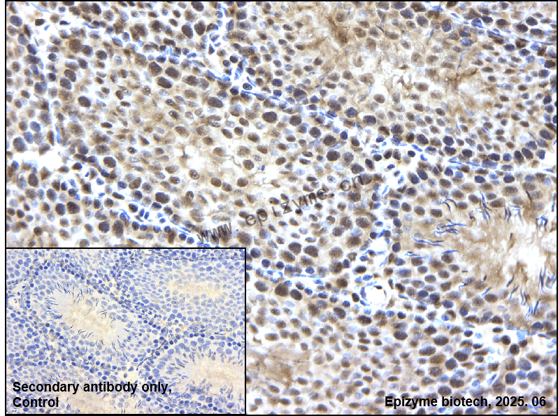 Anti-Phospho-PKC (Thr514) Rabbit mAb [16K92M36]