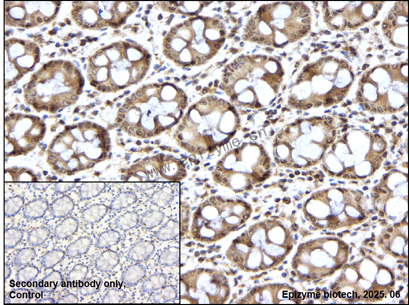 Anti-Phospho-PKC (Thr514) Rabbit mAb [16K92M36]
