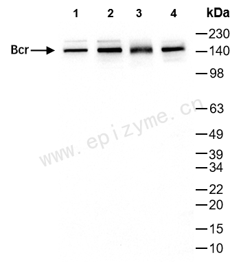Anti-Bcr Rabbit mAb [67K24M92]