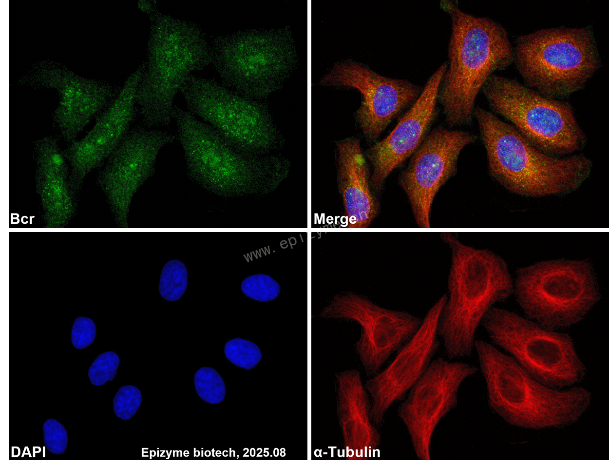 Anti-Bcr Rabbit mAb [67K24M92]