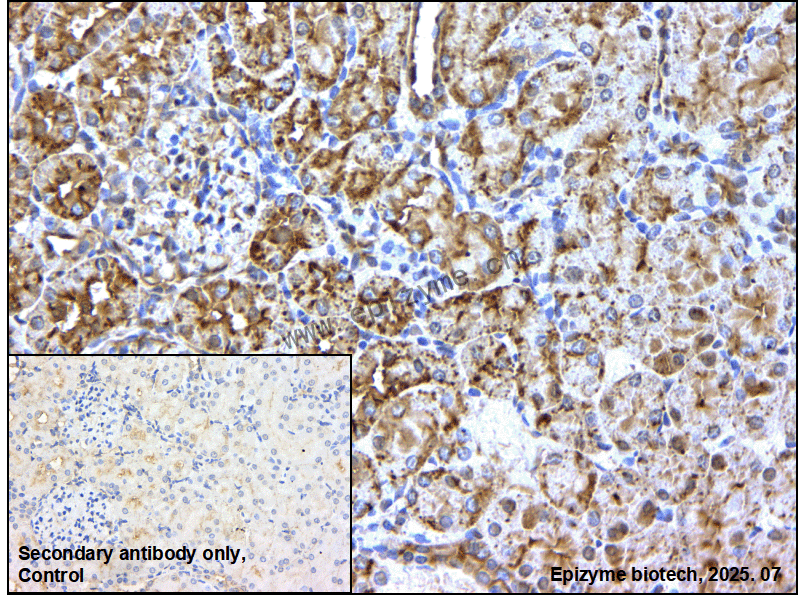 Anti-Bcr Rabbit mAb [67K24M92]