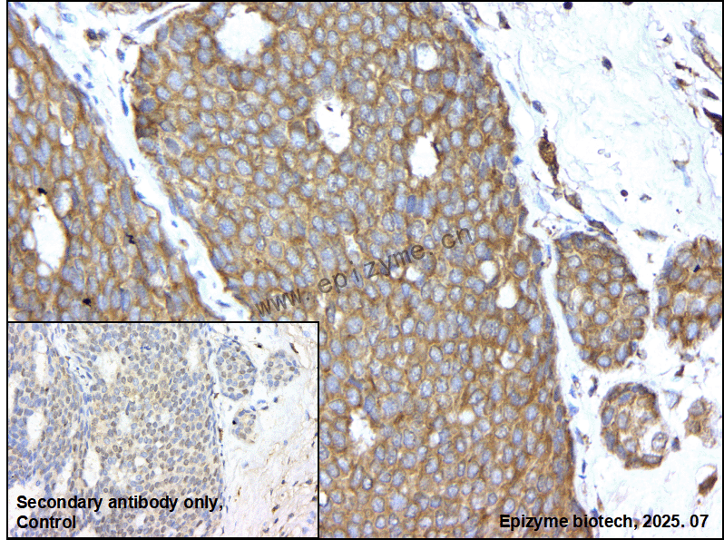 Anti-Bcr Rabbit mAb [67K24M92]