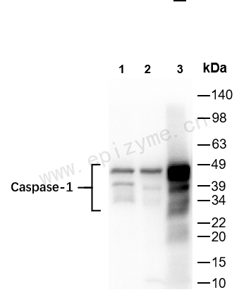 Anti-Caspase 1 Rabbit mAb [83H99E42]