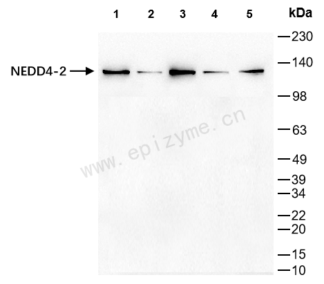 Anti-NEDD4L Rabbit mAb [56F89H65]