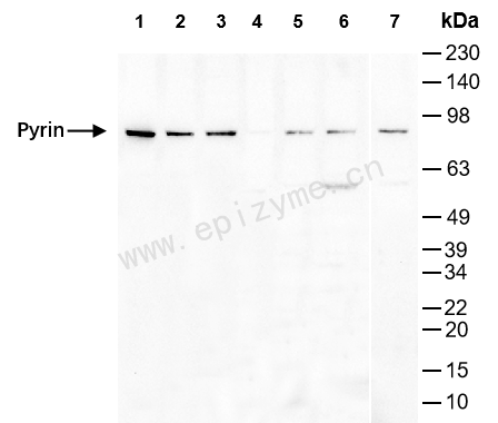 Anti-Pyrin Rabbit mAb [80H71L60]