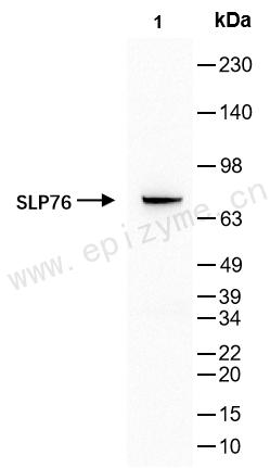 Anti-SLP76 Rabbit mAb [81V06E02]