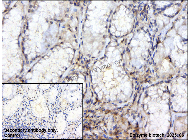 Anti-SLP76 Rabbit mAb [81V06E02]