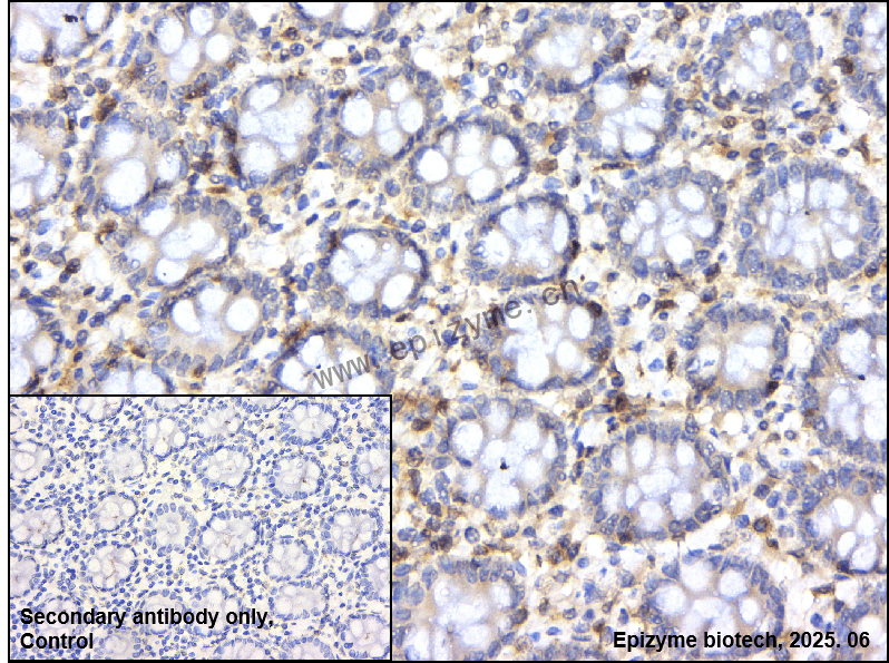 Anti-SLP76 Rabbit mAb [81V06E02]