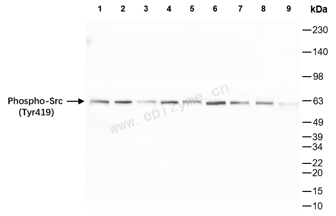 Anti-Phospho-Src (Tyr419) Rabbit mAb [28D09G23]