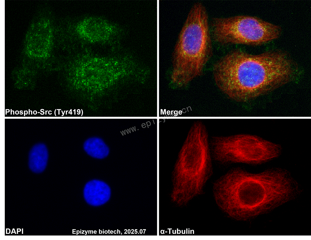 Anti-Phospho-Src (Tyr419) Rabbit mAb [28D09G23]