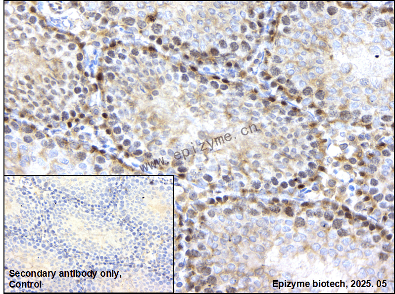 Anti-KIF4A Rabbit mAb [48S81G12]