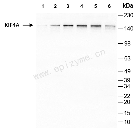 Anti-KIF4A Rabbit mAb [48S81G12]