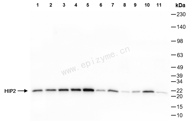 Anti-HIP2 Rabbit mAb [54M79S25]