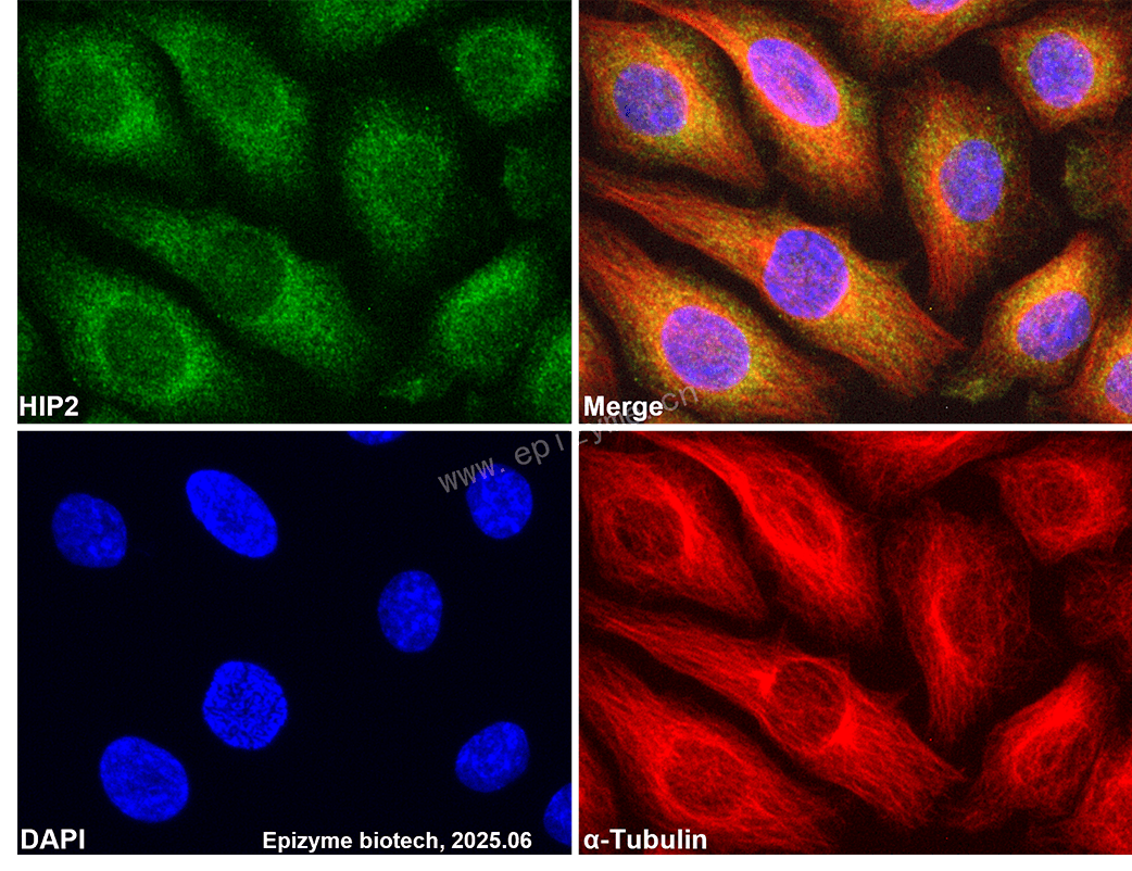Anti-HIP2 Rabbit mAb [54M79S25]