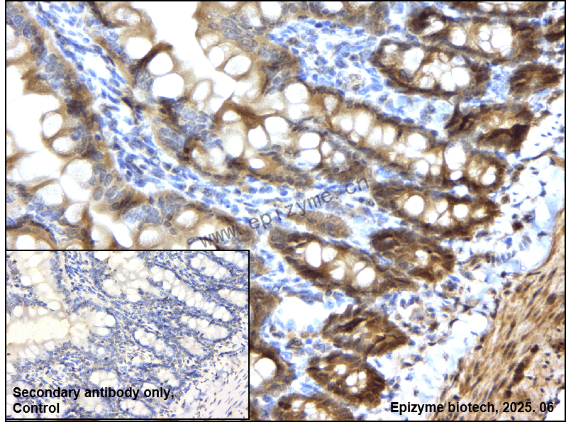 Anti-HIP2 Rabbit mAb [54M79S25]