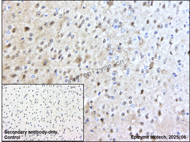 Anti-HIP2 Rabbit mAb [54M79S25]