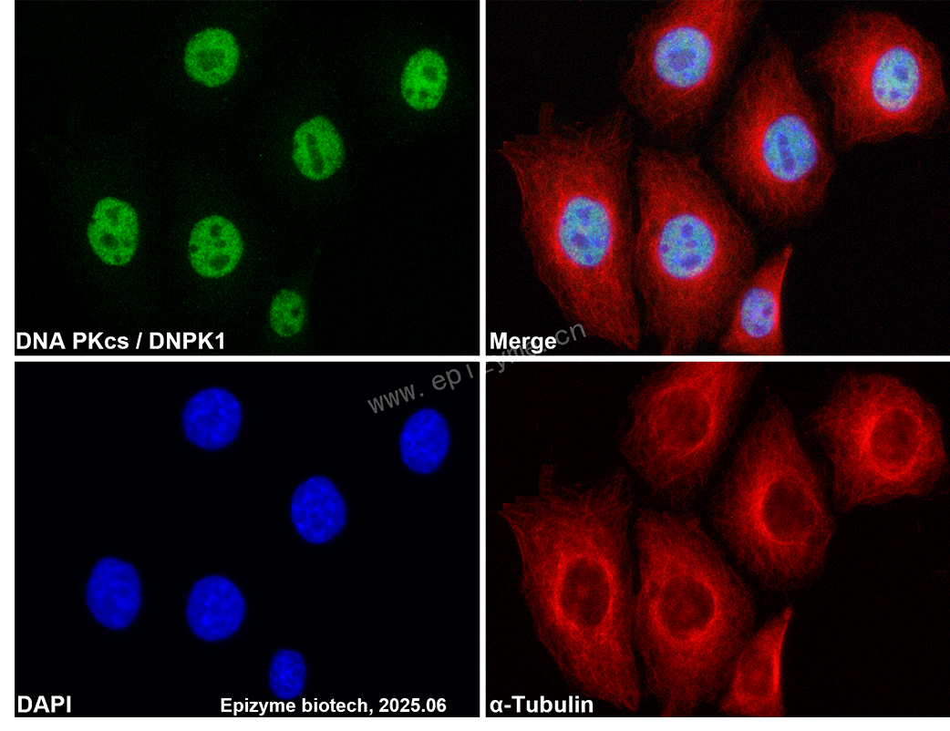 Anti-DNA PKcs Rabbit mAb [93F85Q66]