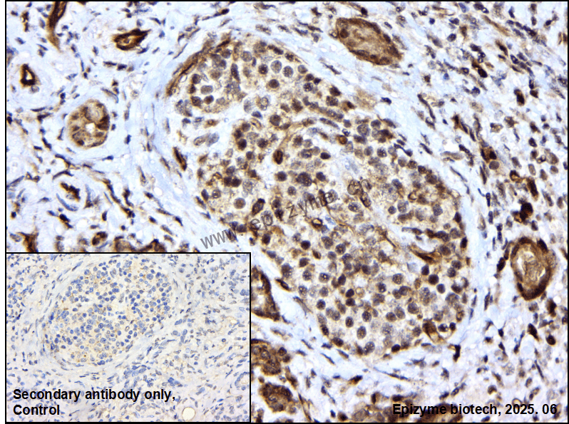 Anti-DNA PKcs Rabbit mAb [93F85Q66]