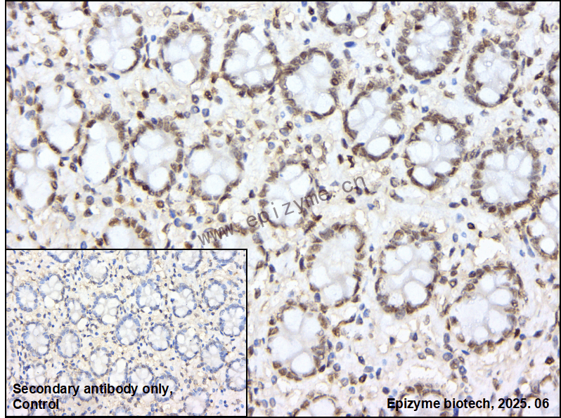 Anti-MAX Rabbit mAb [96K19F99]