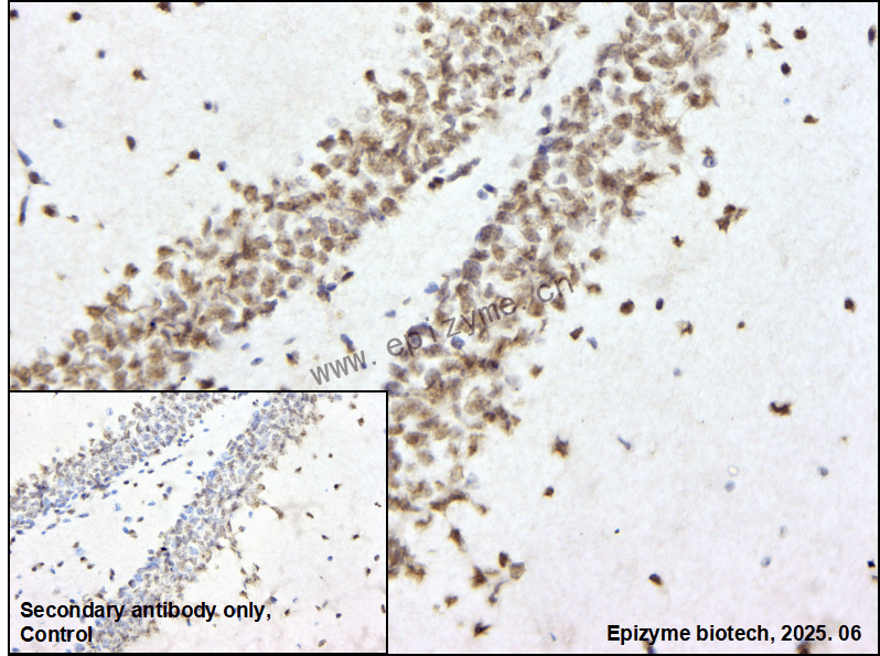 Anti-MAX Rabbit mAb [96K19F99]