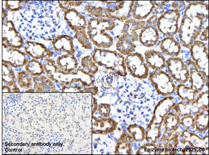 Anti-PIGU Rabbit mAb [18M37C87]