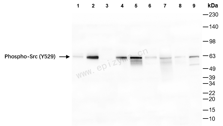 Anti-Phospho-Src (Tyr529) Rabbit mAb [16M51G85]
