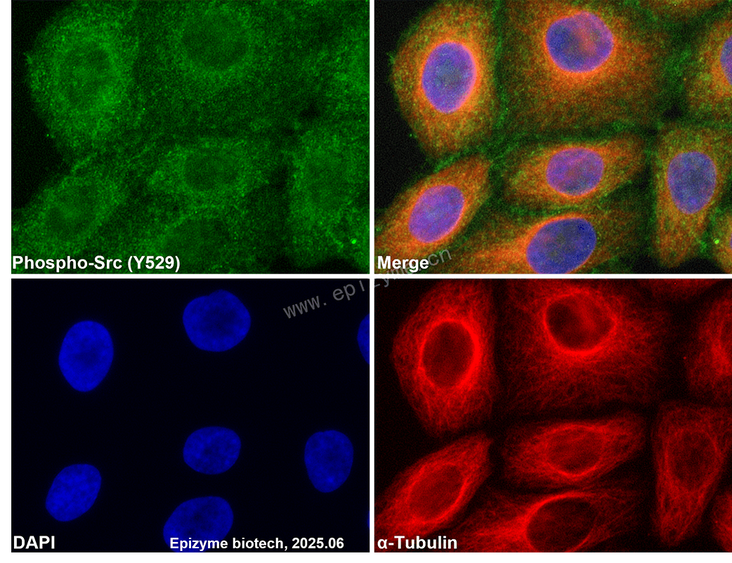 Anti-Phospho-Src (Tyr529) Rabbit mAb [16M51G85]