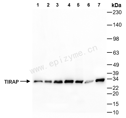 Anti-TIRAP Rabbit mAb [18H54S21]