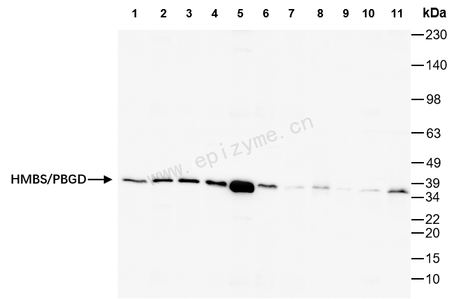 Anti-HMBS Rabbit mAb [95S30D86]