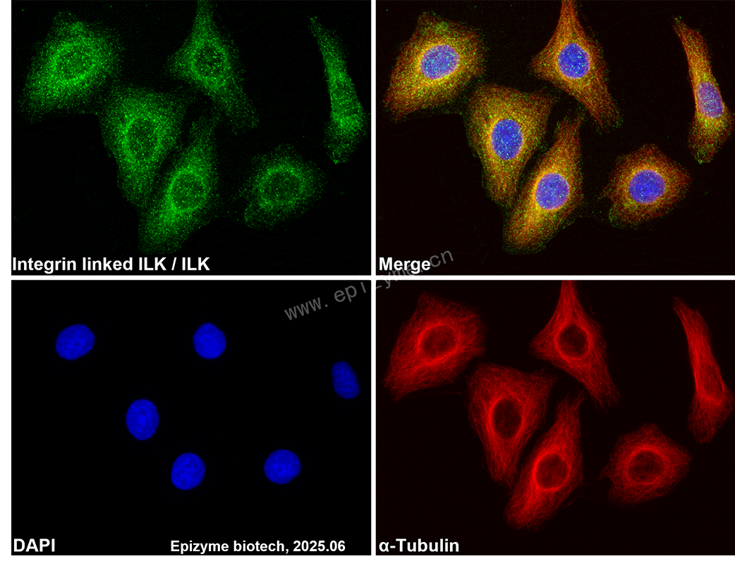 Anti-Integrin linked ILK Rabbit mAb [72M58K81]