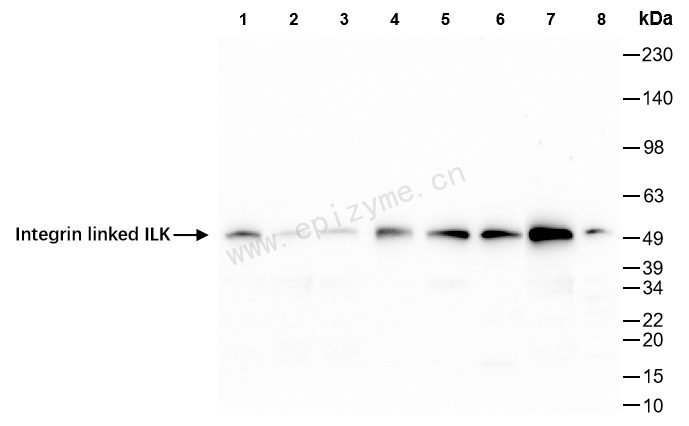 Anti-Integrin linked ILK Rabbit mAb [72M58K81]