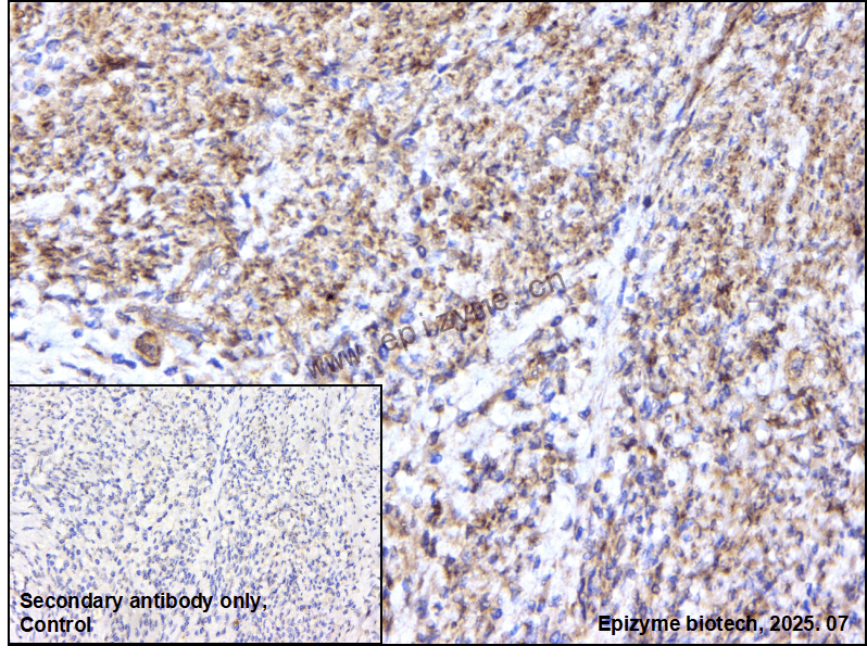 Anti-Integrin linked ILK Rabbit mAb [72M58K81]