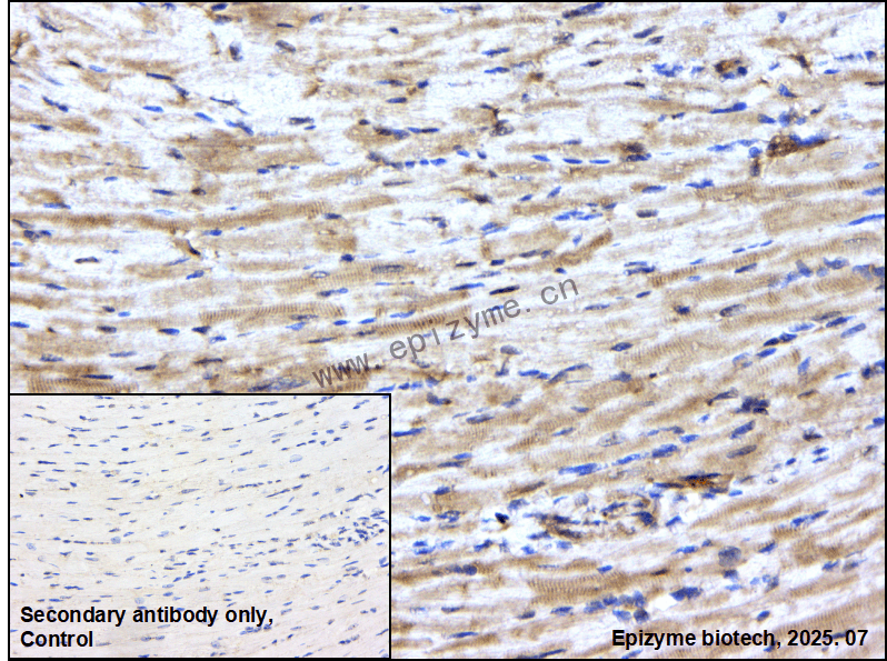 Anti-Integrin linked ILK Rabbit mAb [72M58K81]
