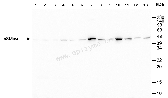 Anti-nSMase Rabbit mAb [95N03Q17]