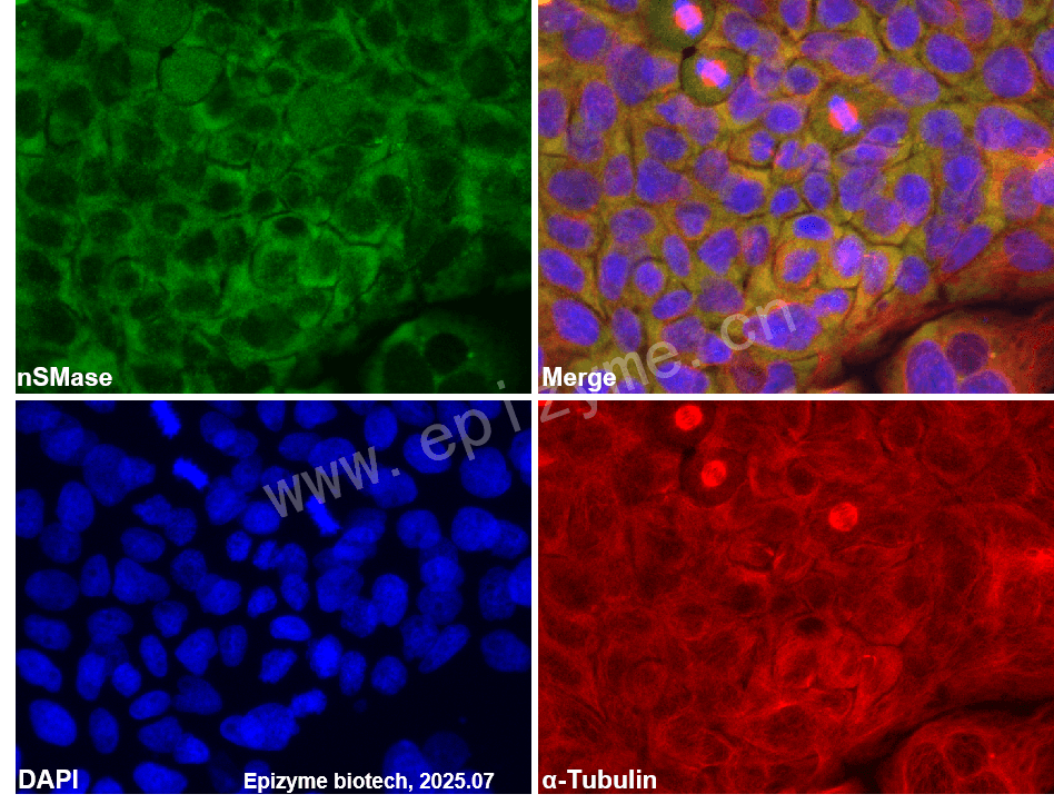 Anti-nSMase Rabbit mAb [95N03Q17]