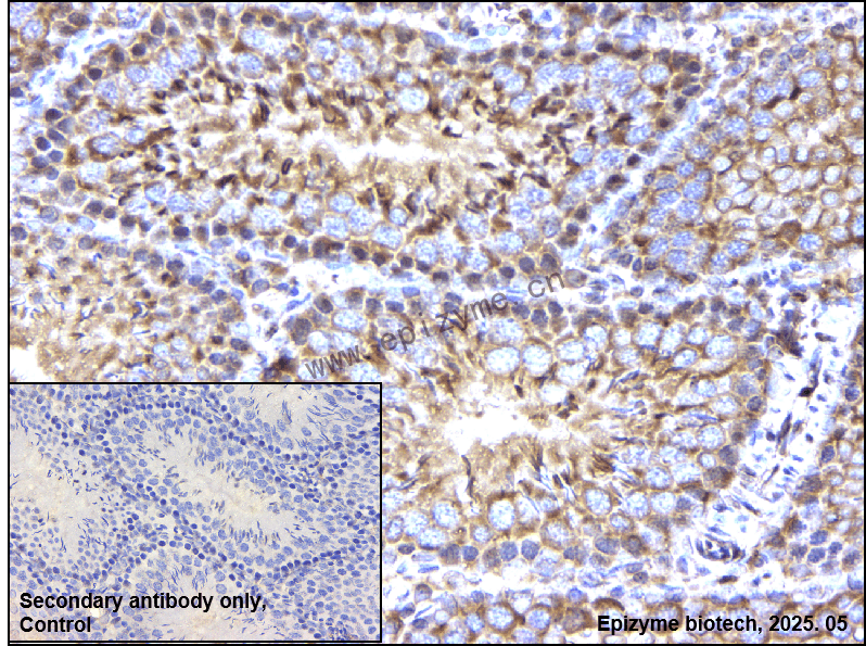 Anti-nSMase Rabbit mAb [95N03Q17]