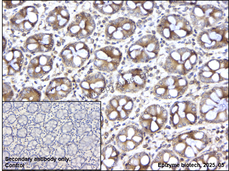 Anti-nSMase Rabbit mAb [95N03Q17]