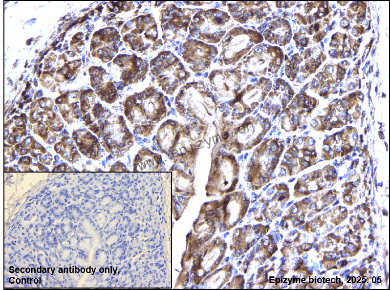 Anti-nSMase Rabbit mAb [95N03Q17]