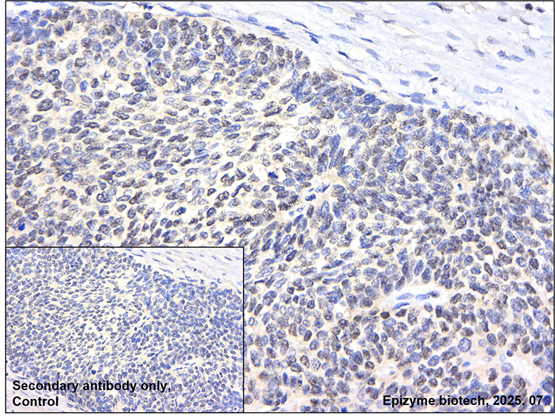 Anti-ETS2 Rabbit mAb [11P95B00]